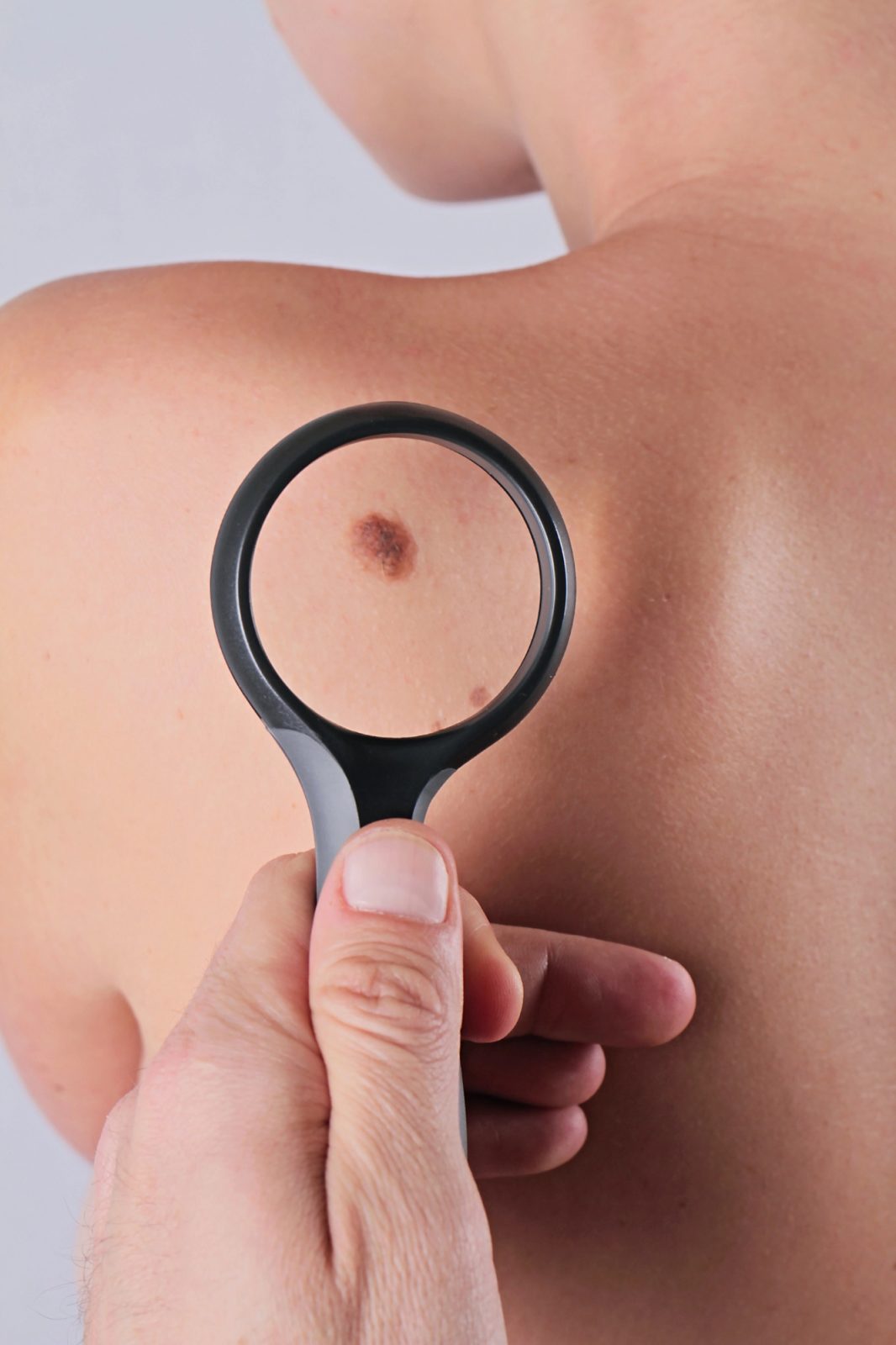 Postati dermatolog ni preprosto